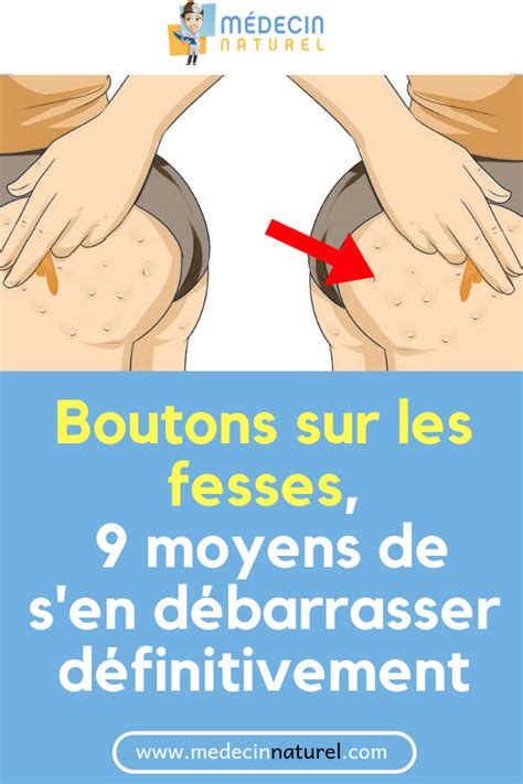 bouton sur les fésses homme|Boutons sur les fesses : comment en venir à bout